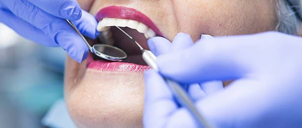 Best Emergency Dental Services for Seniors in Salem, IL